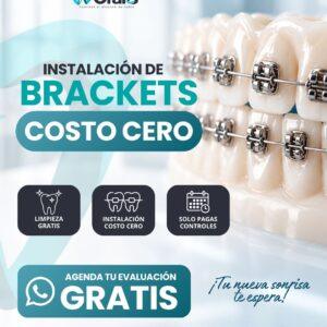 ortodoncia costo $0