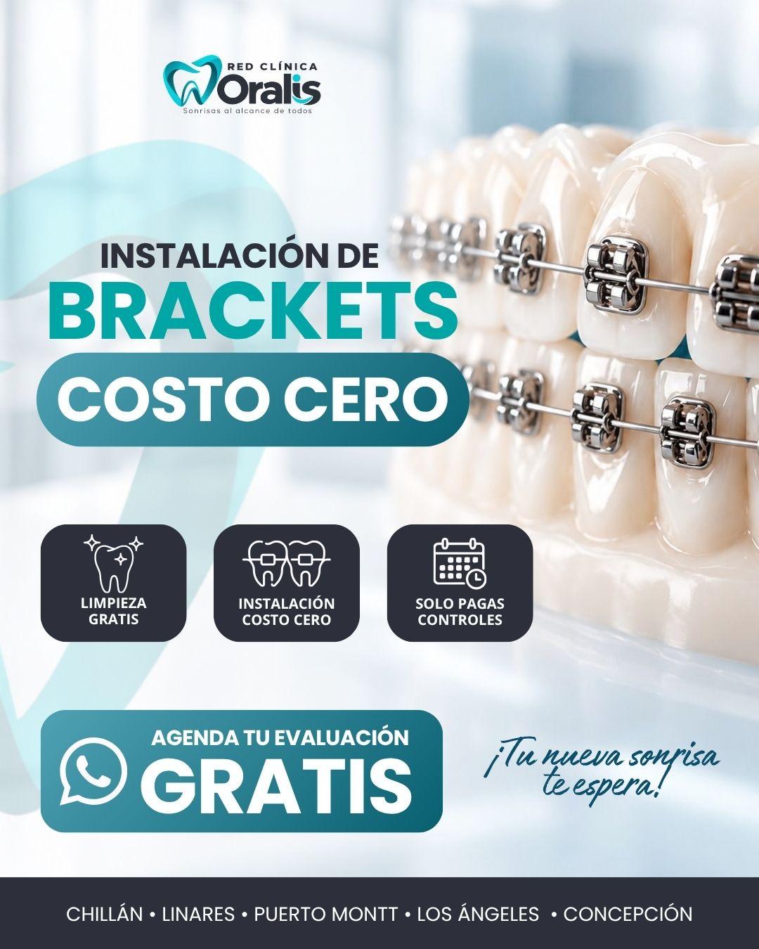 ortodoncia costo $0